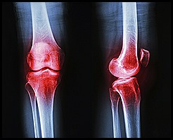 normal human's knee
