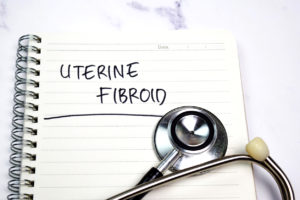 Uterine Fibroid on top view yellow table. Healthcare/medical concept.